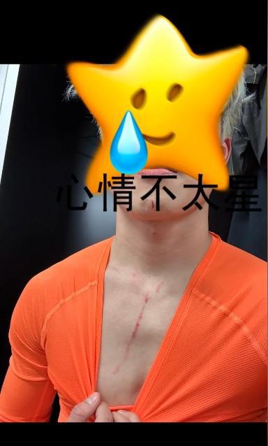 妻子謝文能傷痕照，安慰說無礙，誰不心疼？