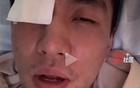 郭艾倫眼傷曝光，臺灣球員已道歉，專家警告可能失明。